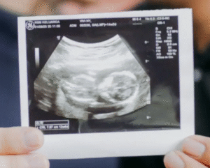 echofoto magneet om zwangerschap aan te kondigen aan meter en peter